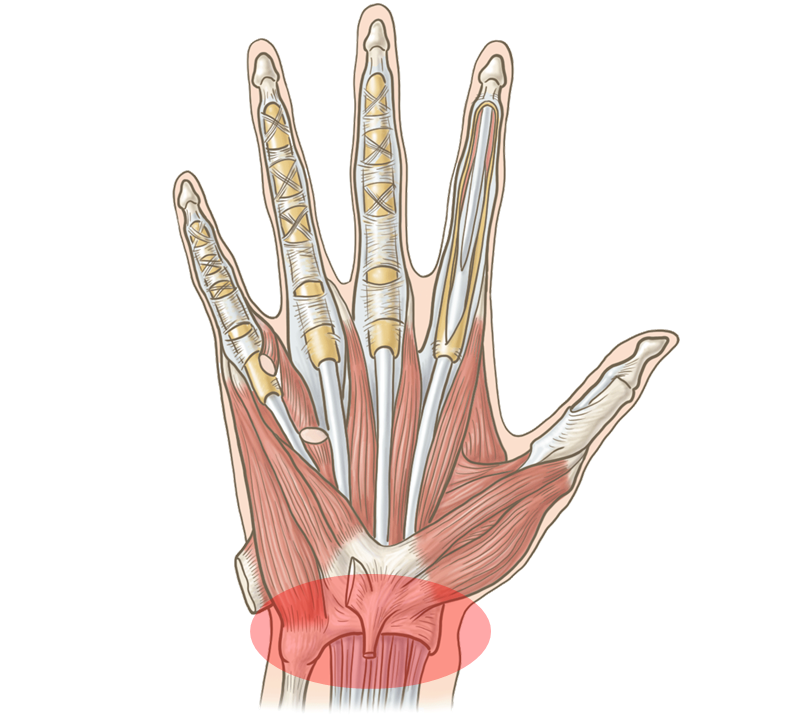 手の筋肉の構造と手首の痛めている画像