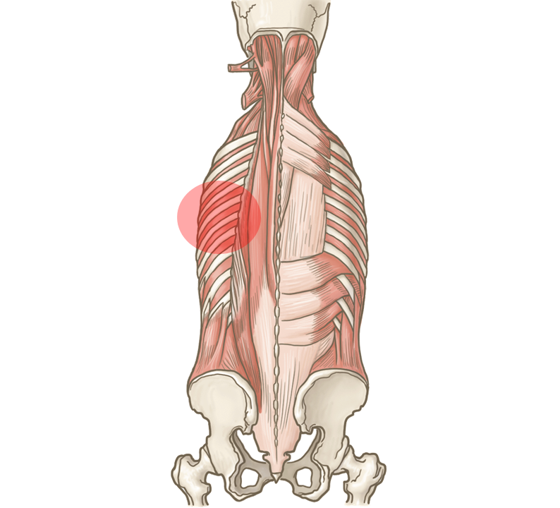 体の背面の筋肉の構造と傷めている背中の画像