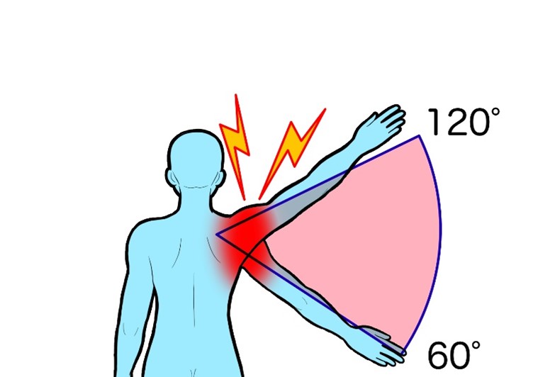 肩の可動域のイラスト
