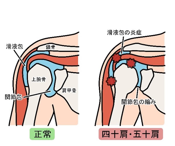 肩関節の解剖イラスト