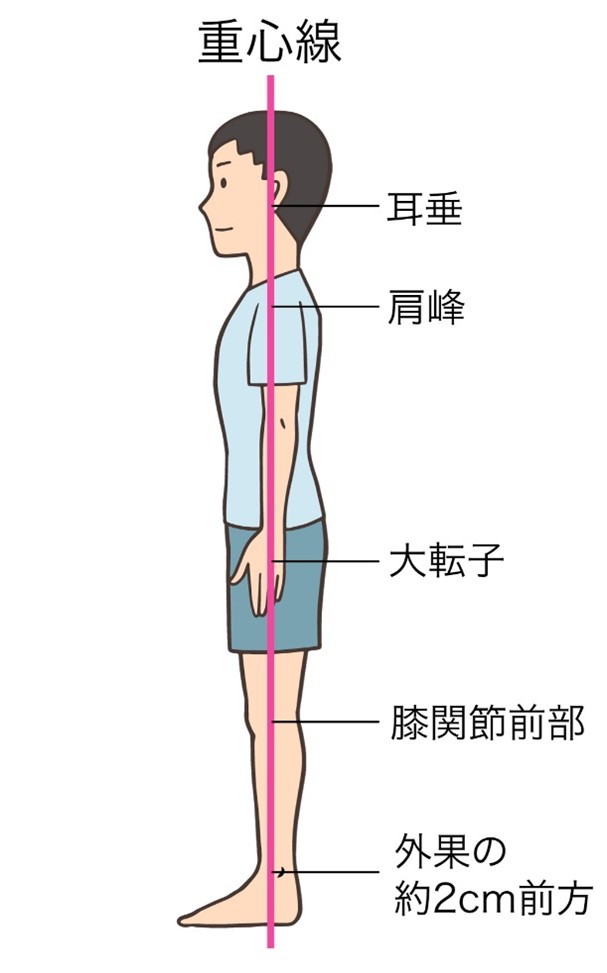 姿勢の診方のイラスト