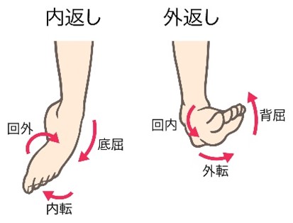 足関節捻挫の分類の画像